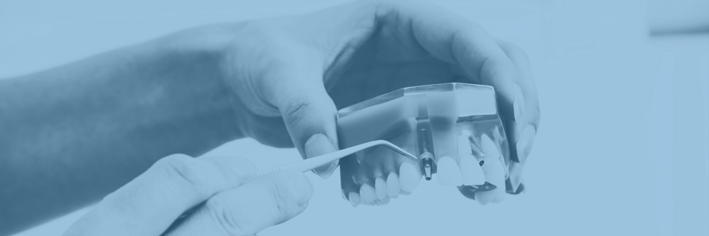 dental implants nyc