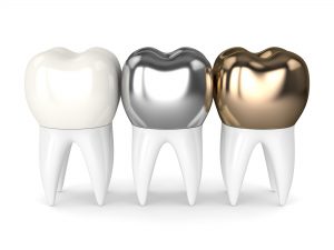 dental crowns are available with metal, porcelain, ceramic, or resin materials