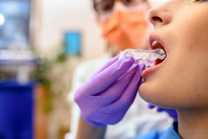 Invisalign vs Braces NYC