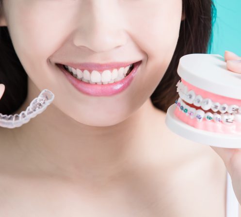 Braces vs Invisalign NYC Orthodontist
