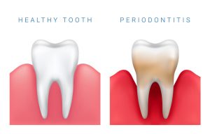 how do you know if you have bad dental health