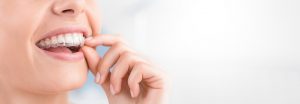 What can be fixed with an Invisalign?